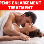 Penis Enlargement Treatment in Patel Nagar Delhi